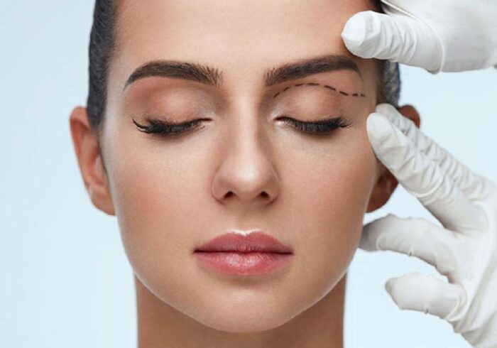 Eyelid Surgeon